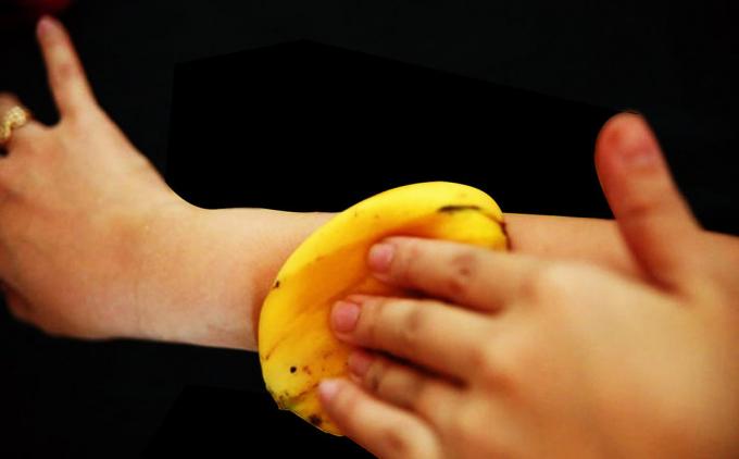 Банан кожата перфектно облекчава сърбеж от ухапвания от комари