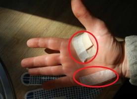 Как да се подобри ръкавиците да се откажат от мазоли?